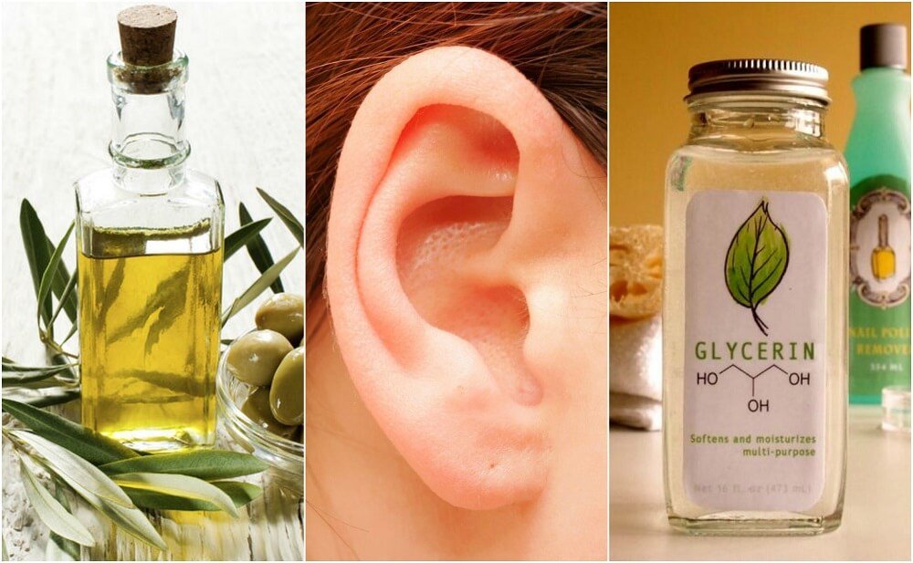 5 remedios naturales para limpiar tus oídos sin dañarlos - Mejor